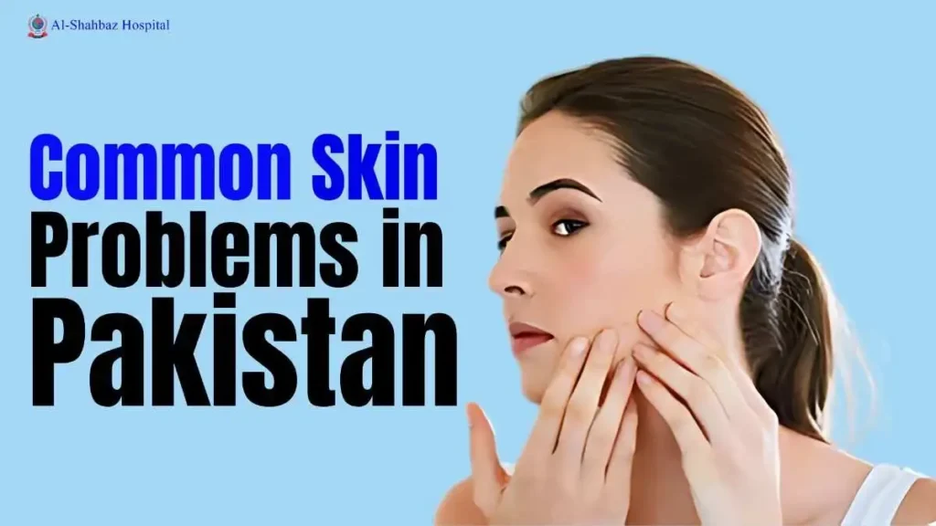 Skin Problems in Pakistan
