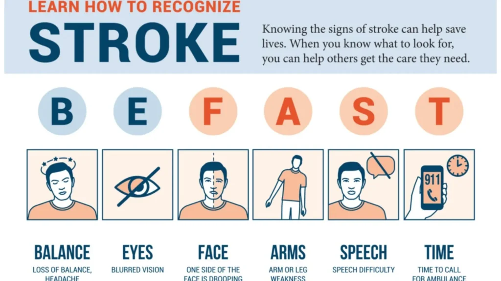 sign of stroke sign of stroke